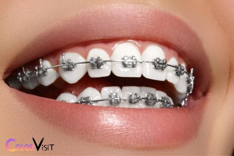 Is Black A Bad Color For Braces No 